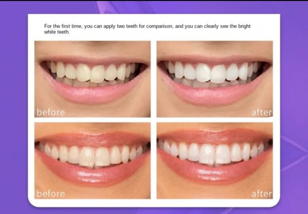 Teeth Brightening Hi smiles V34 Color Corrector Serum 30ml